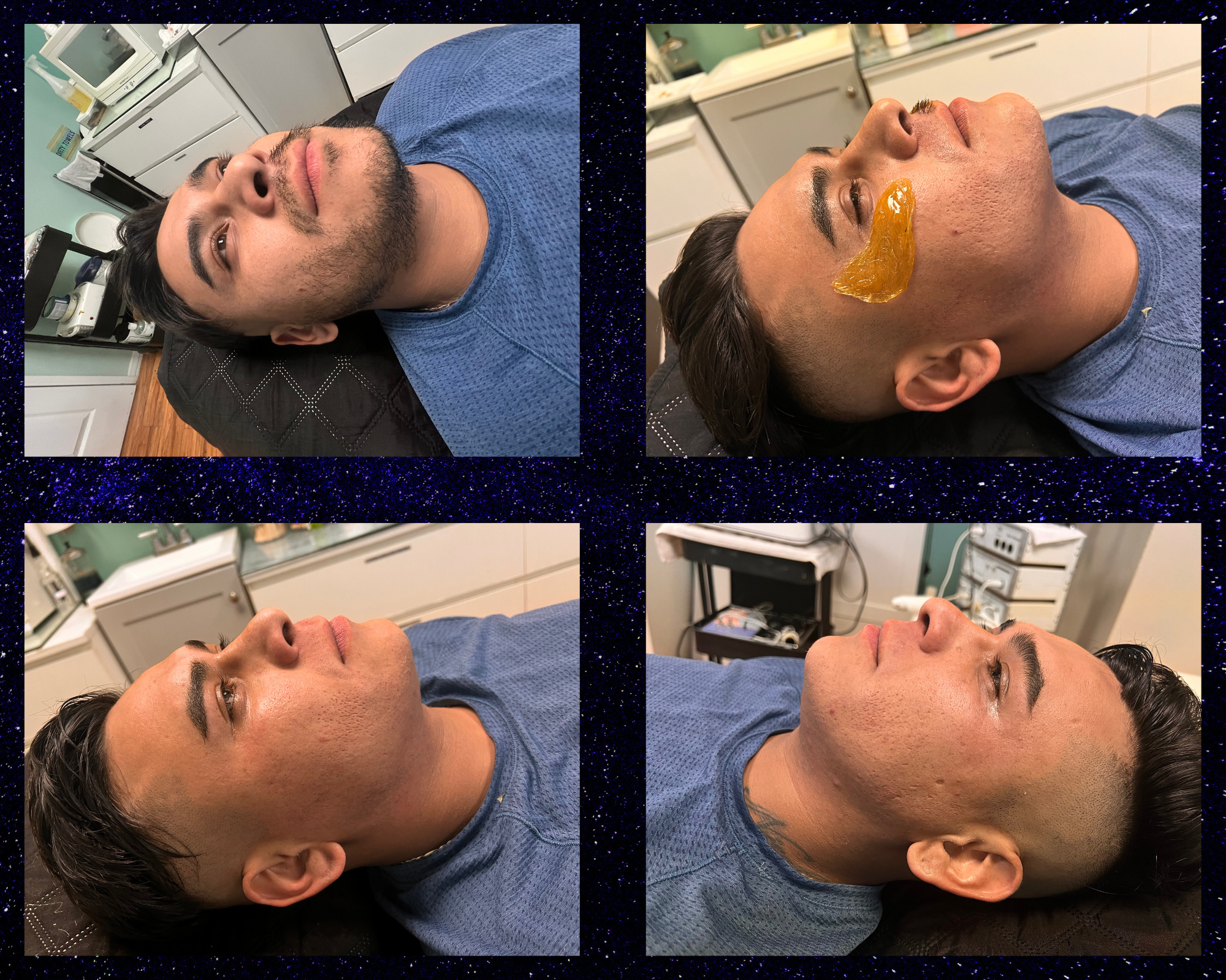 FACE MEN BEER WAX at Oasis Healing Esthetics in Los Angeles, CA