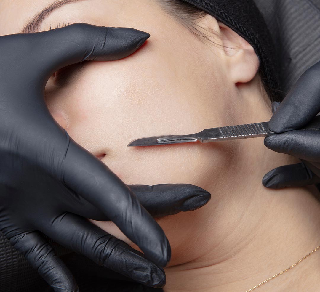 Dermaplane at RADBEAUTYLAB in murfressboro, TN