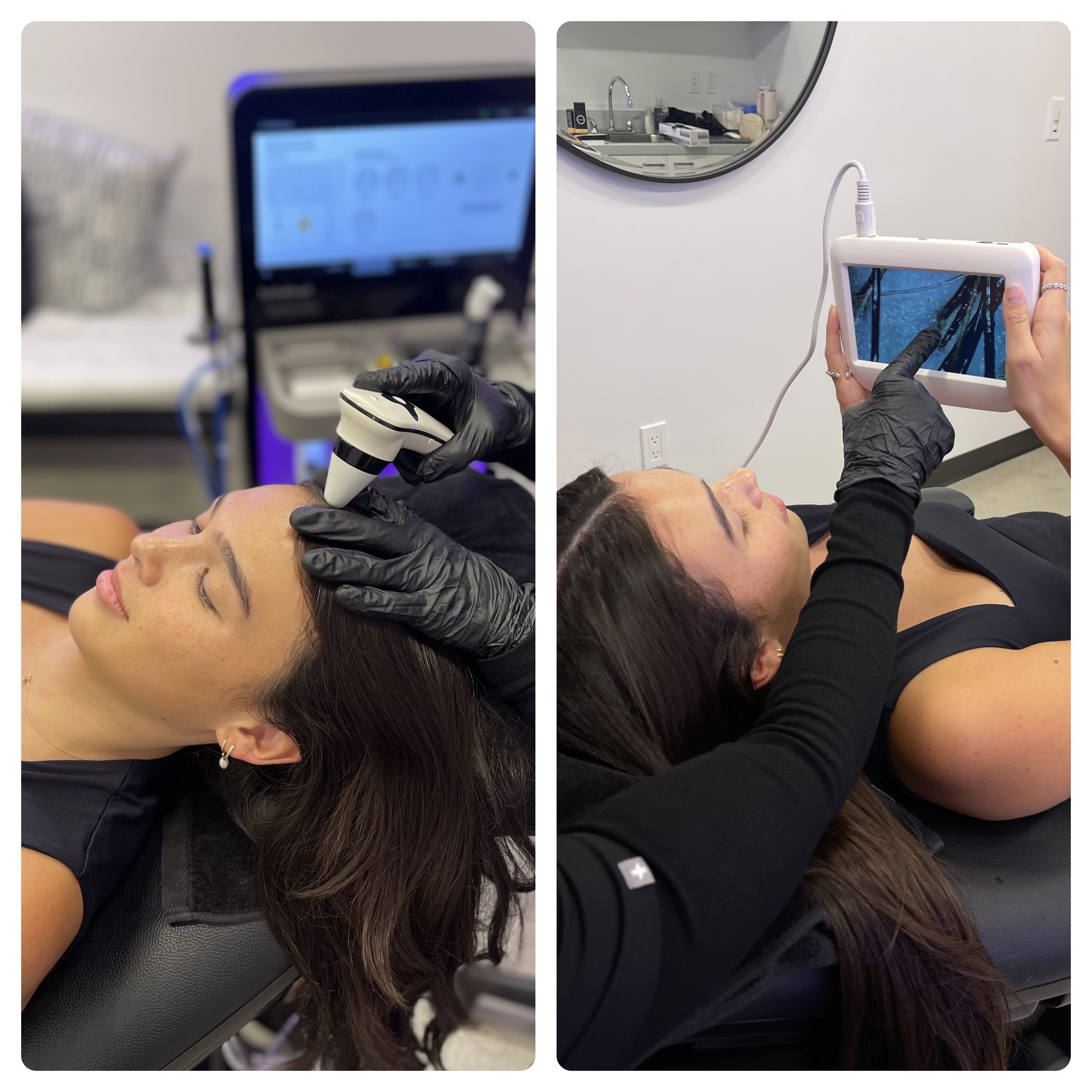 Clean Scalp Facial - Half Scalp