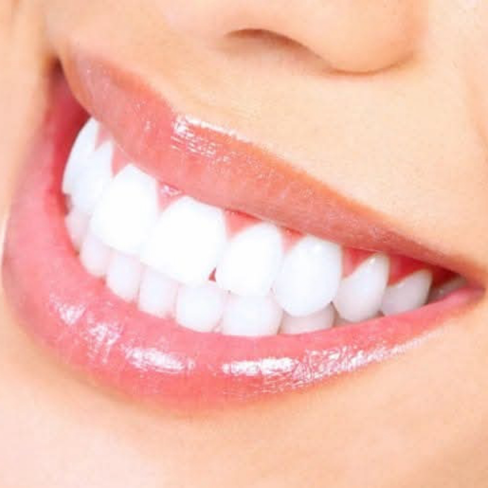 Teeth Whitening at Lash Vibes in Stayton, OR