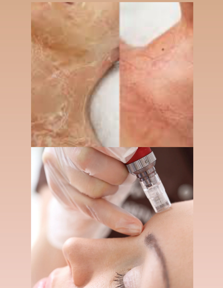 Luminous Lift For Face And Neck