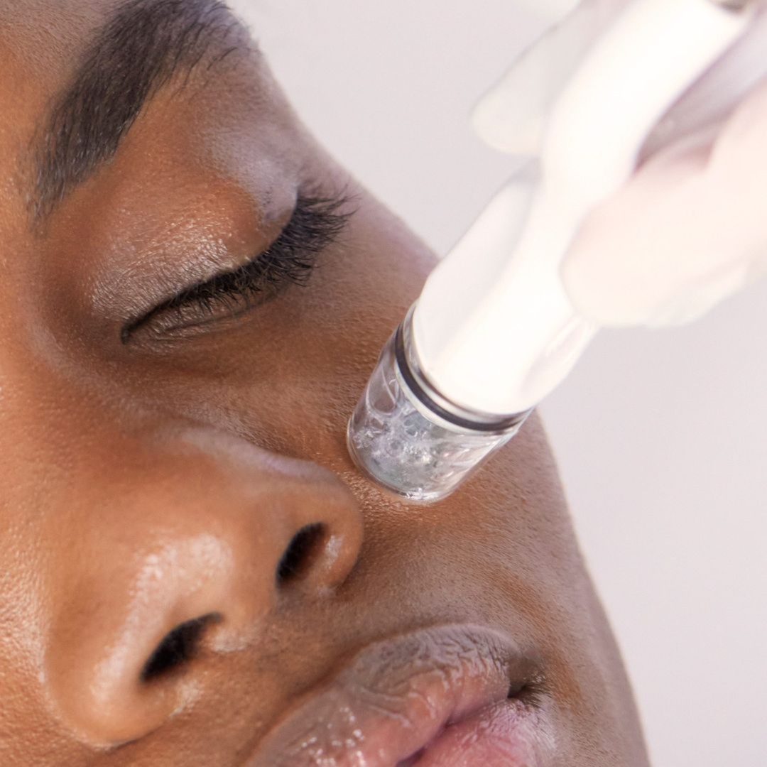 Hydra Facial (Deep Pores cleanse) at Luxe Royale Spa in Paramus, NJ