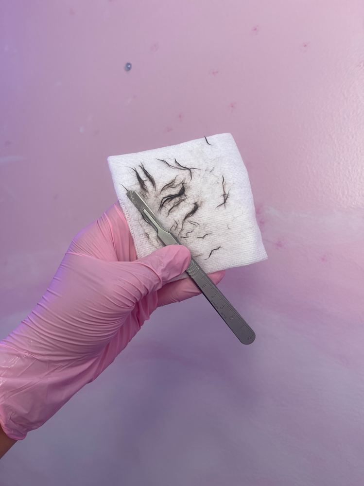 Dermaplaning Facial (Most Popular)