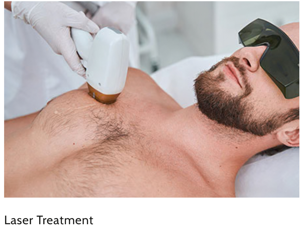 Laser Hair Removal - Large Area