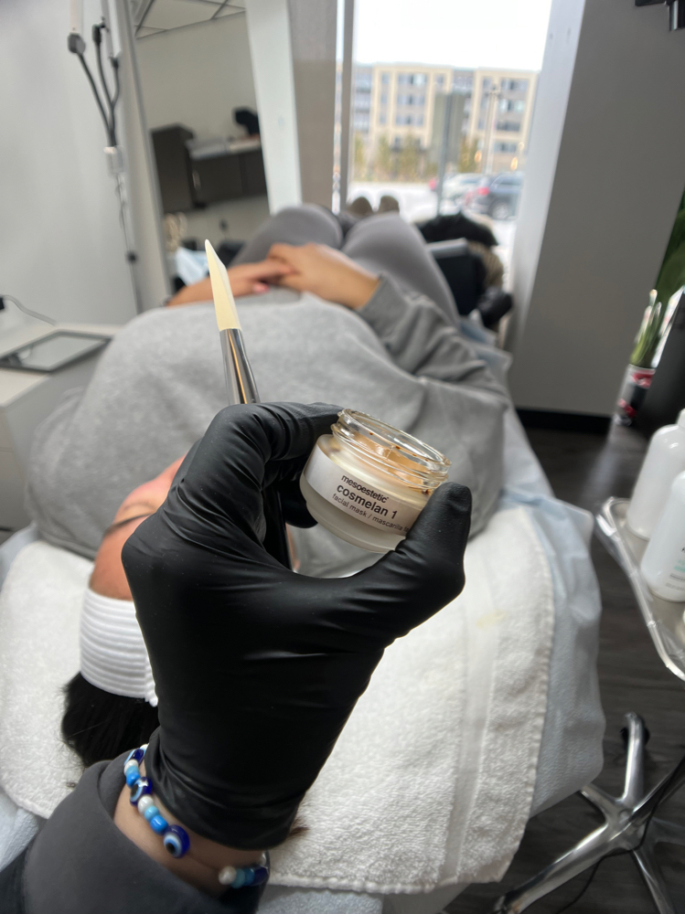 Hyperpigmentation Fcl Cnslt & Prep