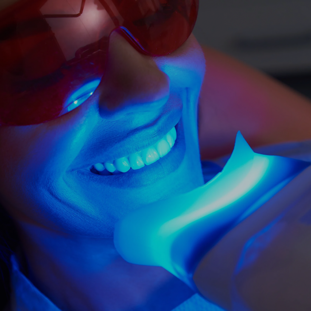 Regular Teeth Whitening 60 Minute