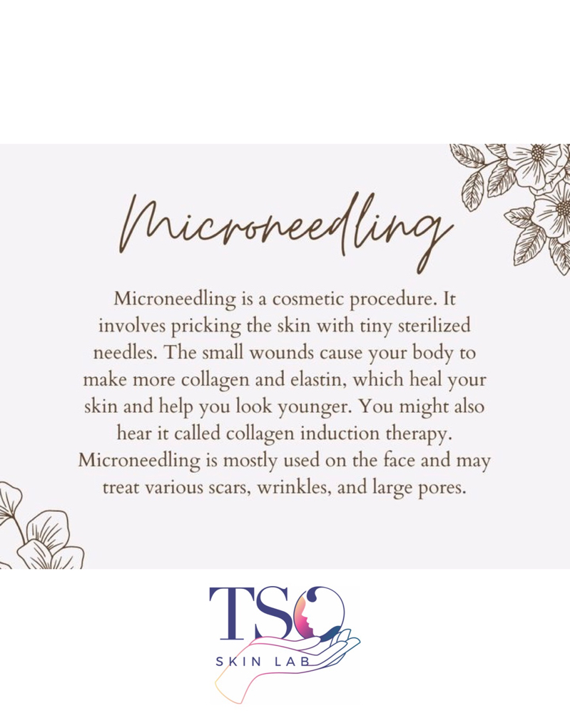 Microneedling