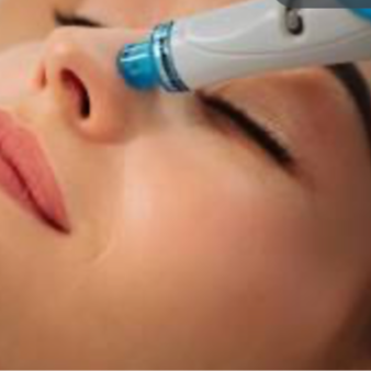 Express Hydrafacial (30 Min) at Lanehart Aesthetics in Lutherville Timonium, MD