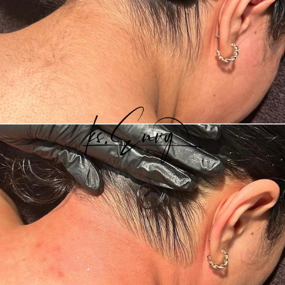 Face: Neck at KS.Envy in Columbus, OH