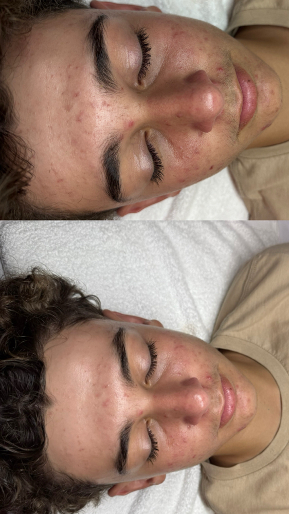 Teen Facial *17yrs & Under*