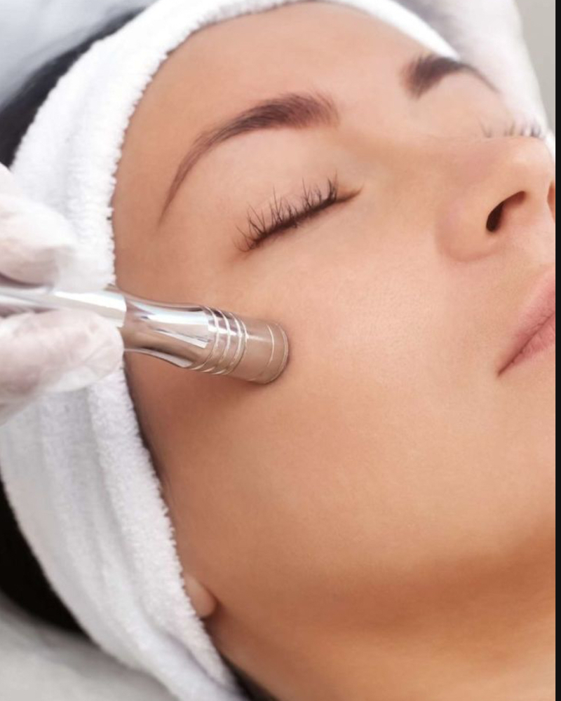 Microdermabrasion