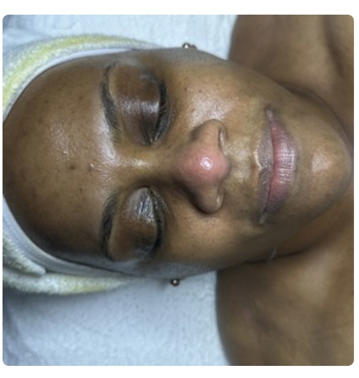 Anti-aging Facial