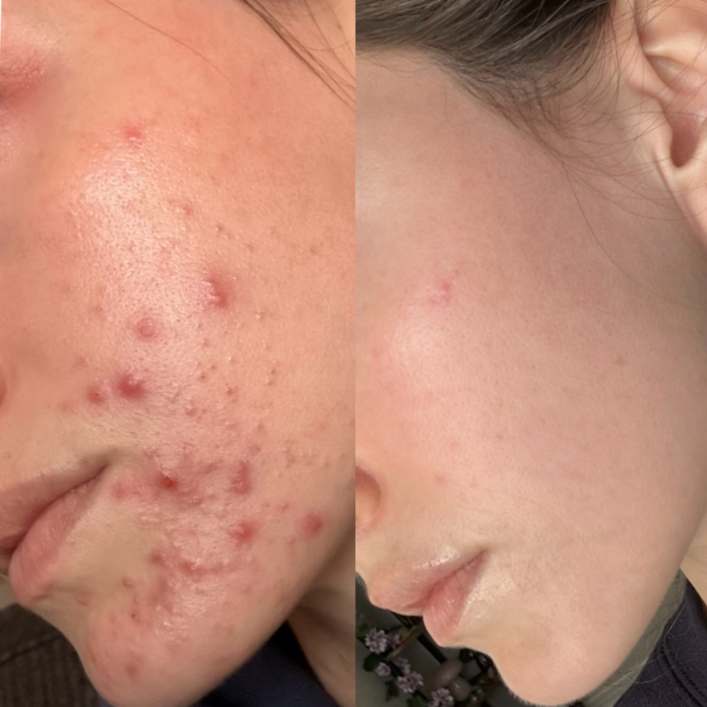 The Transformation Package at The Apothecary in Denton, TX