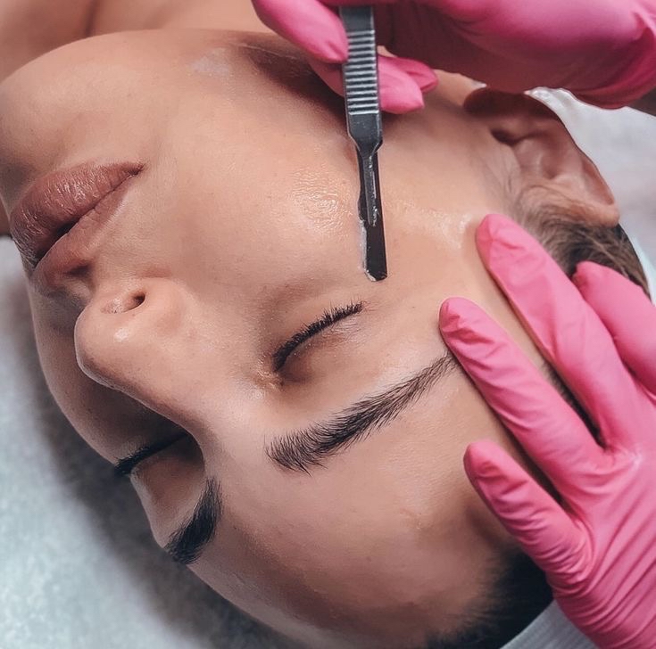 Dermaplane Facial W/peel at Refined Skin Center in Houston, TX