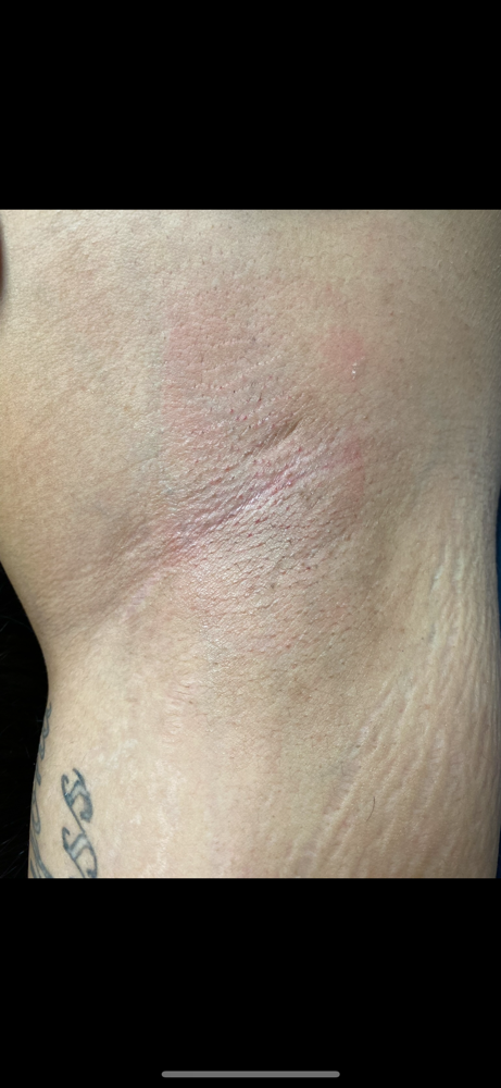 Underarm Wax