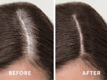 Root Touch Up