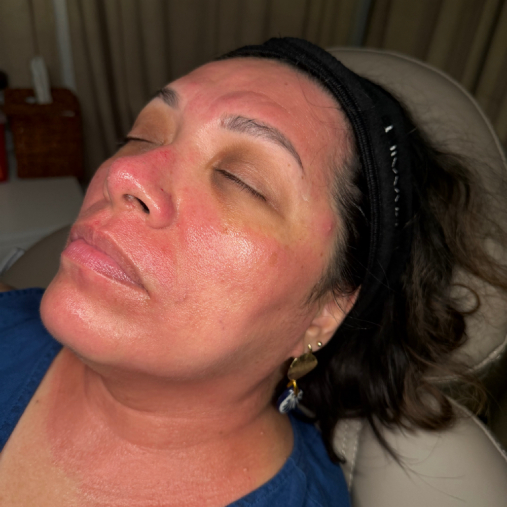 Glass Facial ✨ at She'Tox in San Antonio, TX