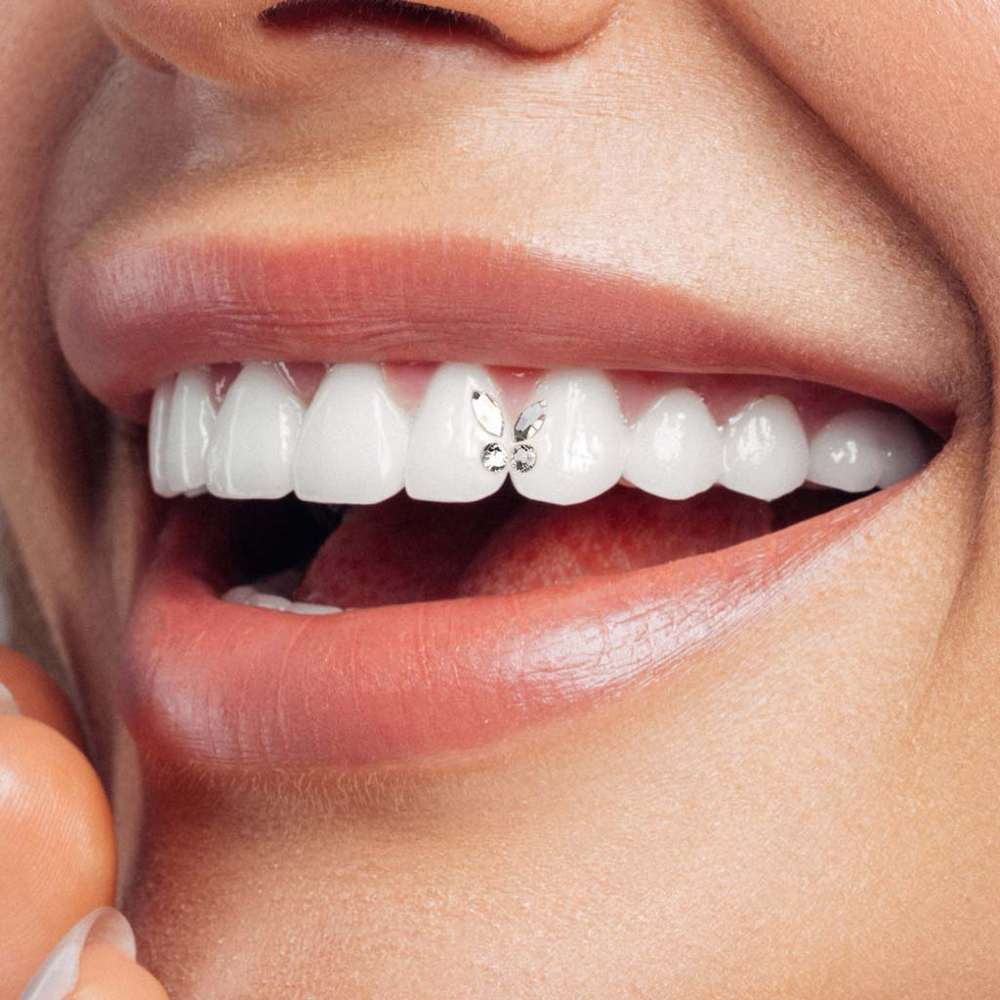 Custom Tooth Gem Designs
