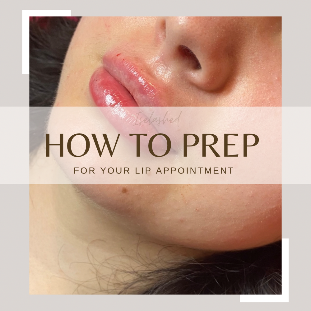 Lip Filler 1ml (Returning Client)