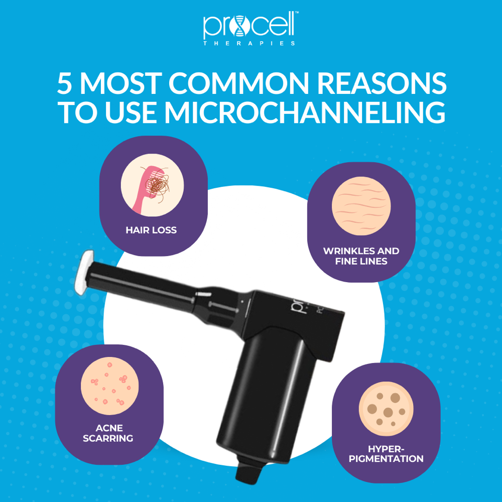 ProCell Microchanneling Treatment