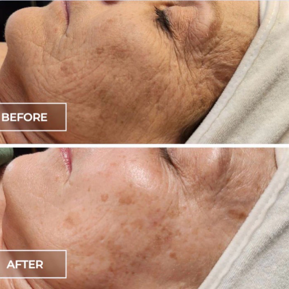 SWiCH Signature Facial at Cameo Beauty Lounge in Delphos, OH