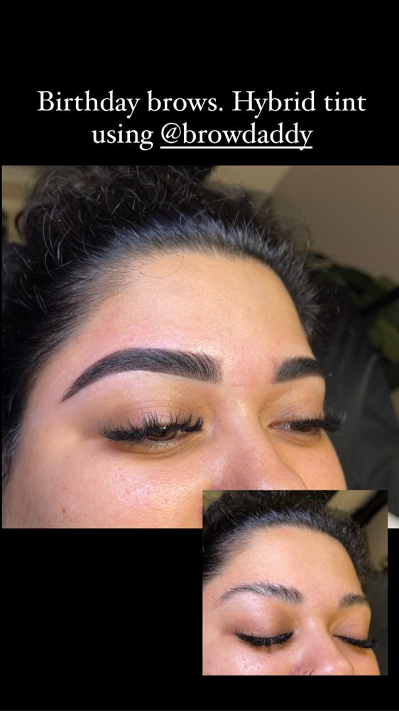 Brow services