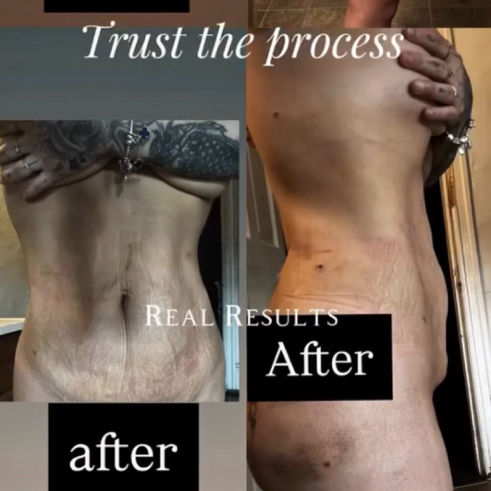 Lymphatic Massage Package (5) at The Beauty Studio by Mia’Love in Allentown, PA