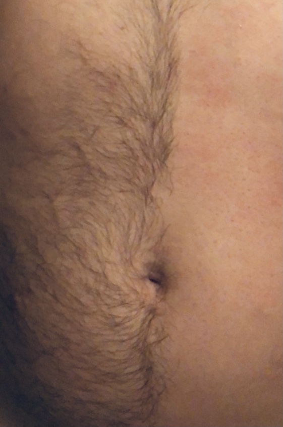 Stomach
