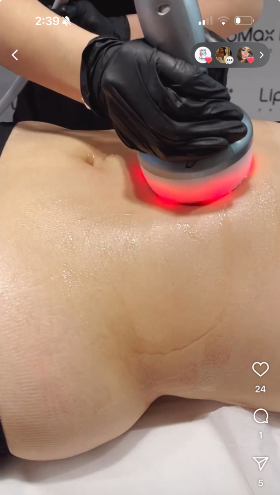 Lipo Dissolve $ Body Contouring