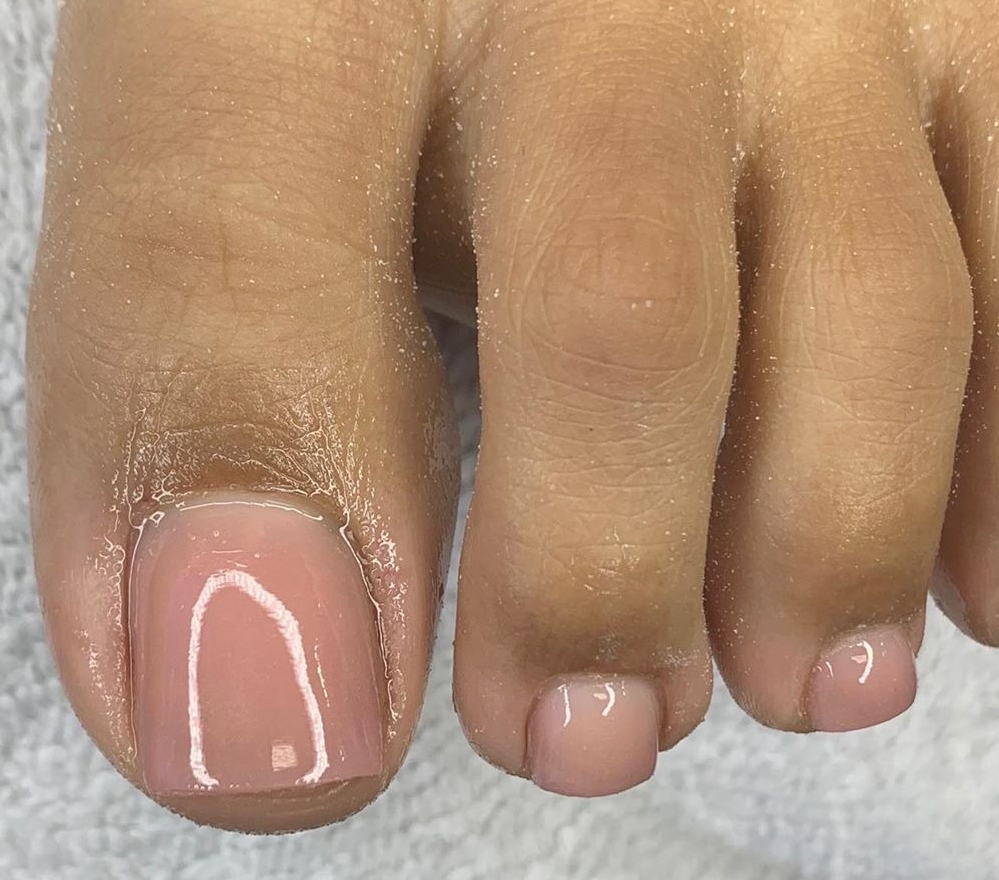Acrylic Toe