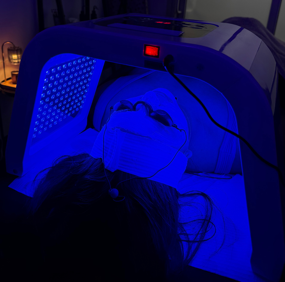 Led Therapy ADD ON ONLY