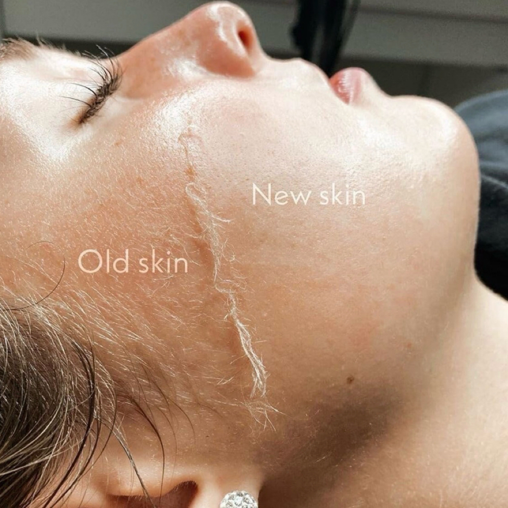 Dermaplane Add-On at The White Brick Hair & Co., LLC in Petersburg, IN