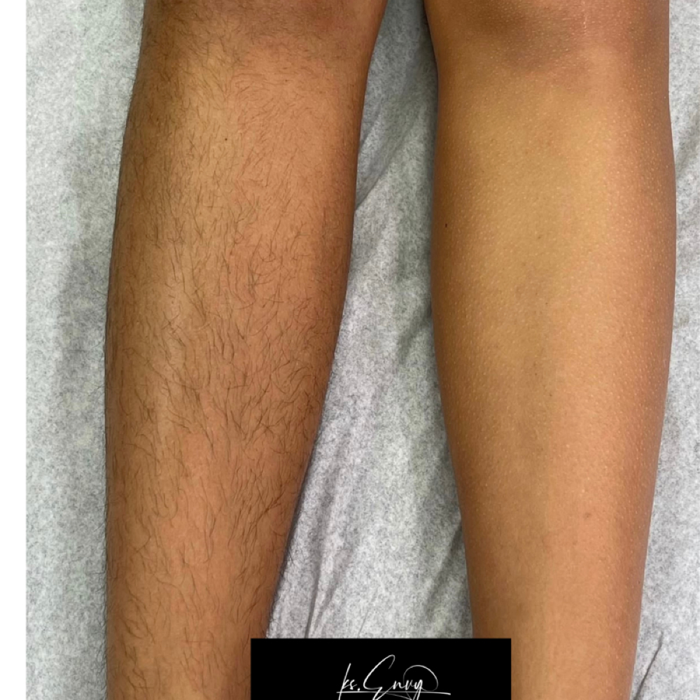 Leg: Lower at KS.Envy in Columbus, OH