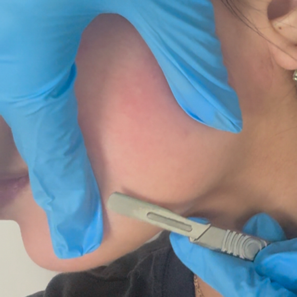 Dermaplane at Heavenly aesthetic studio in Bronx, NY