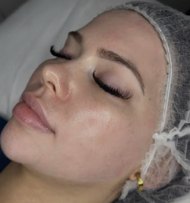 Gotta Glow Microderm at Mix Salon Spa in el paso, TX