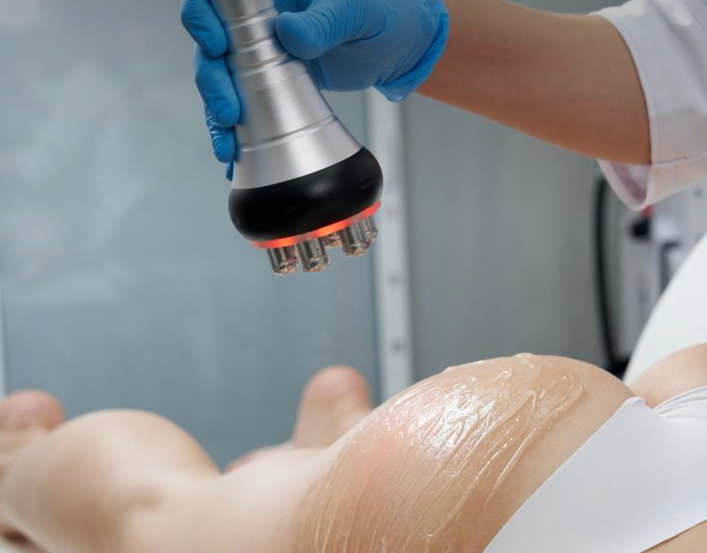 Radio frequency (Skin Tightening) at LuxBeautique in Pawtucket, RI