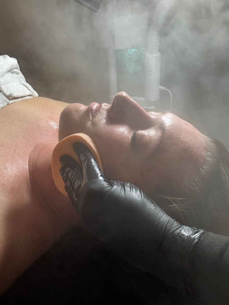 Chemical Peel at SKIN LOVE INDIAN LAKE in Lakeview, OH