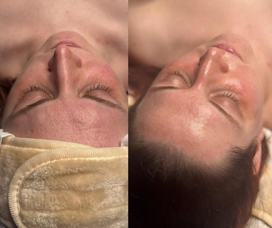 60 Minute Custom Facial