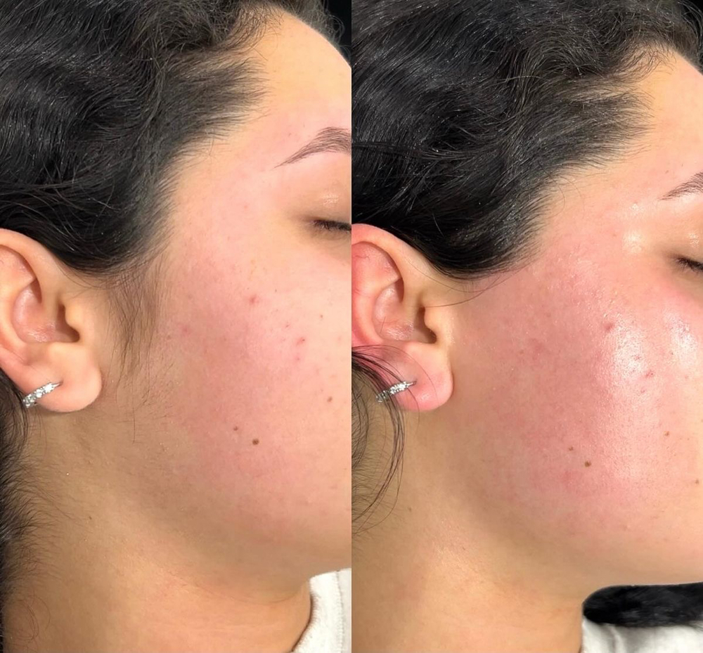 Sideburns at Esoteric Esthetics in Pecos, TX