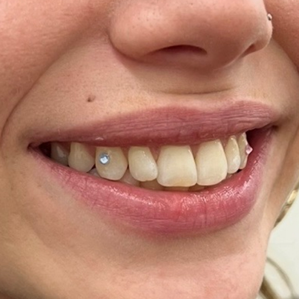 Tooth Gem Application-Open By Appoi at Body Balance by Sara in Orfordville, WI