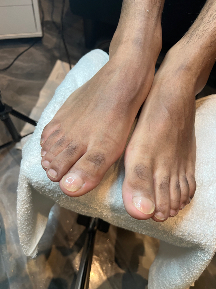 Pedicure