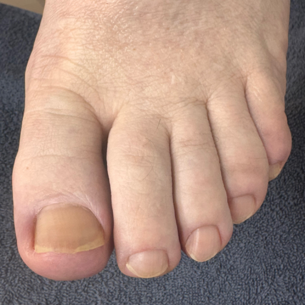 Natural Pedi at Southern Oregon PEDICURE CLINIC in Medford, OR