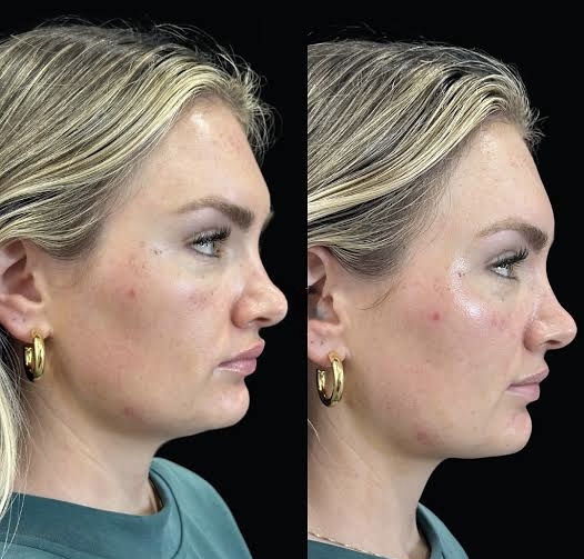 Add On Lymphatic Drainage at grounded wellness in San Antonio, TX