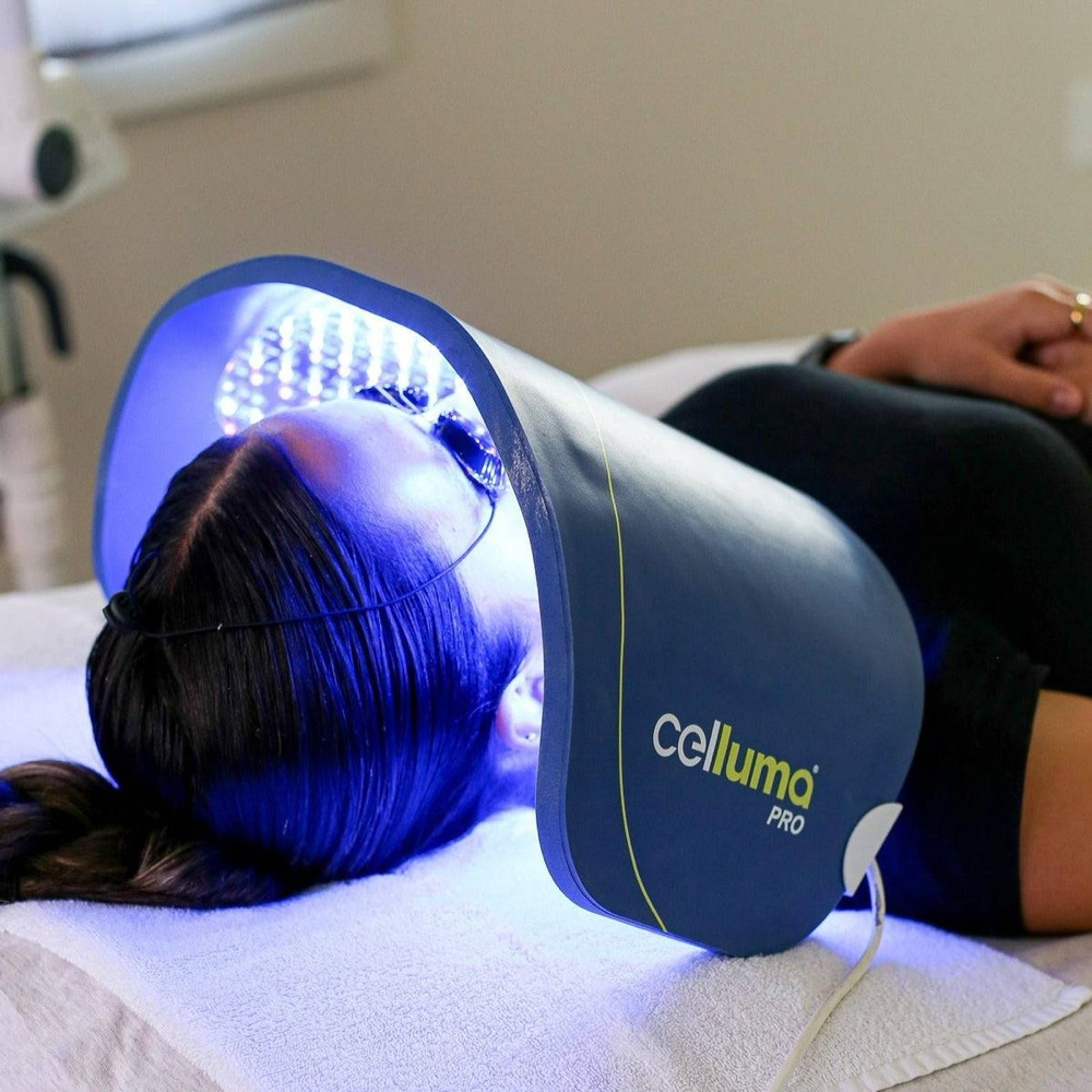 Celluma light therapy for acne