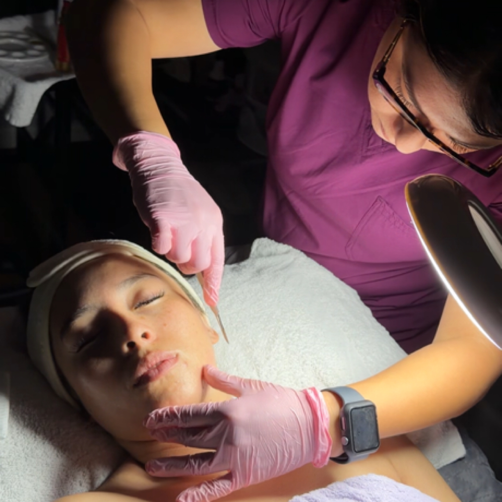 ✨dermaplane (Add On) at Radiant Beauty By Selene in Fresno, CA