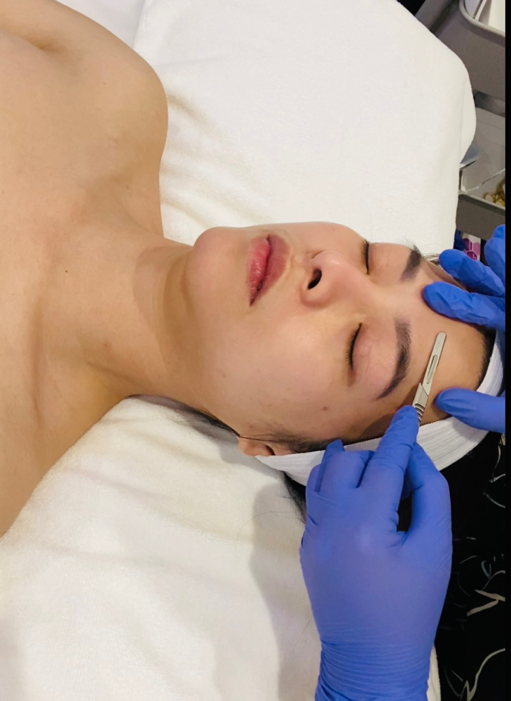 Dermaplaning Facial