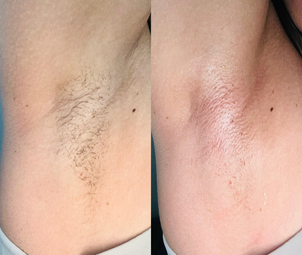 Underarm Wax