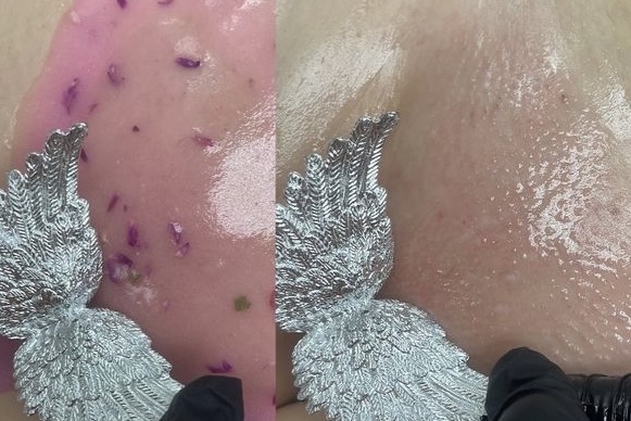 Brazilian Wax