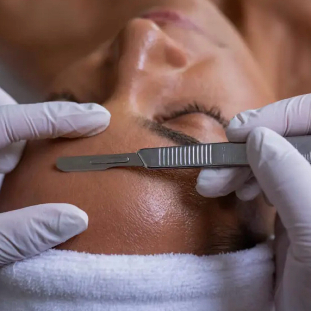 Dermaplane Facial-Model Only at S.T. Esthetics in Michigan City, IN