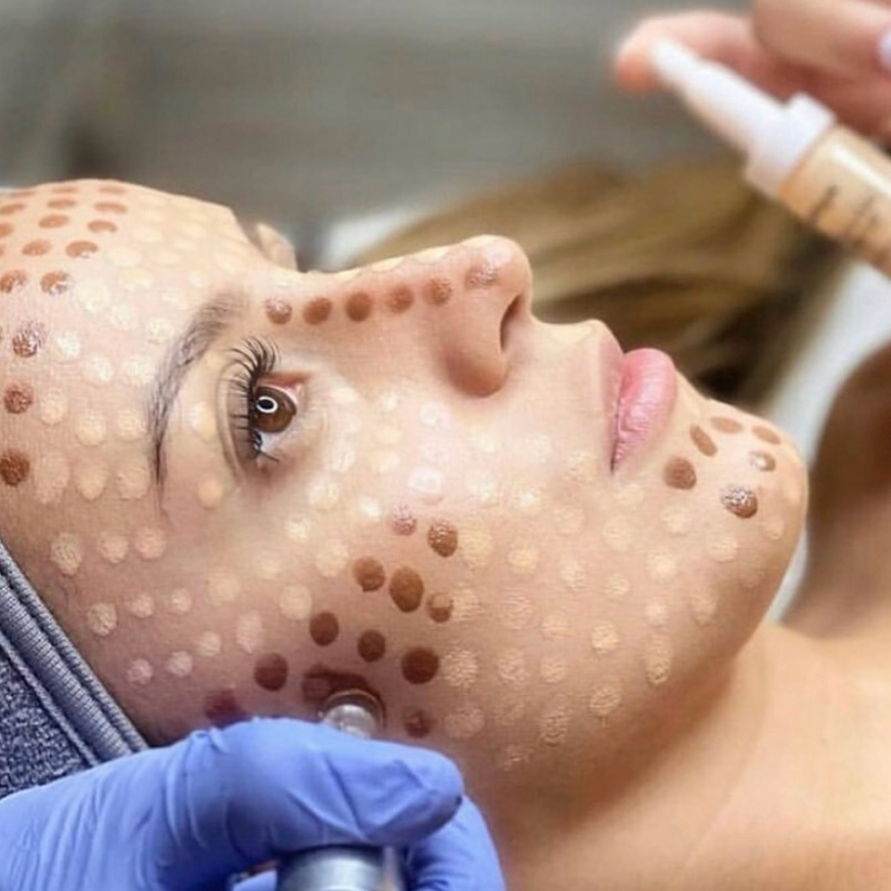BB Glow Full Face Treatment Facia at Glow Beauty Lounge in New Concord, OH